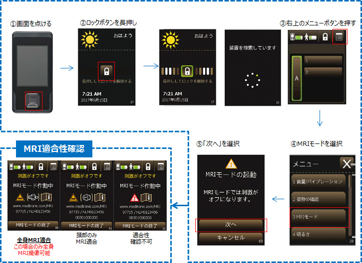 日本語版患者用コントローラを使用する場合