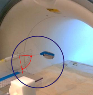 変位力とトルク