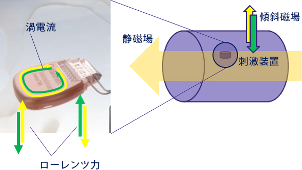 刺激装置の振動