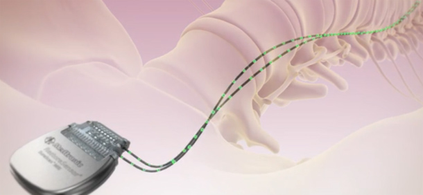 意図しない刺激