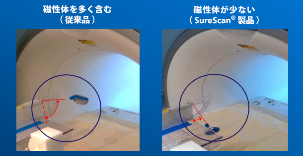 MRI検査時の変位力の比較