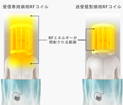 頭部のみMRI適合の場合